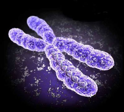 Die Ursache der Migräne ist die Mutation des X-Chromosoms