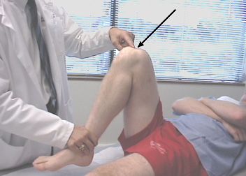 Schmerzen im Knie während der Beugung ist der häufigste Grund, warum Menschen Trauma Ärzte besuchen. 