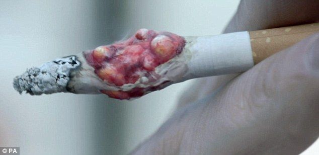 Im Vereinigten Königreich startete eine schreckliche Anti-Werbung Zigaretten